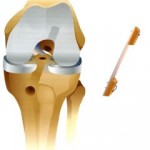Articulatii